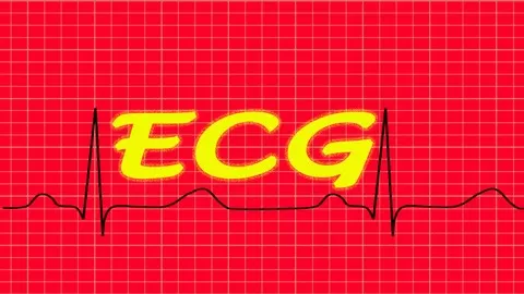 ECG TOPICS FOR AMC MCQ