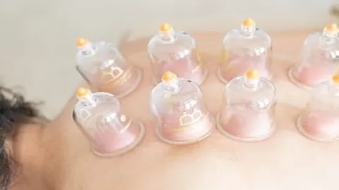 Learn Facial Cupping