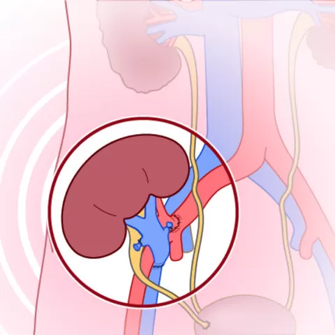 Clinical Kidney