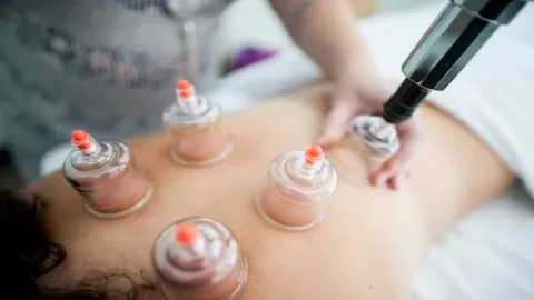 Effectively using cupping therapy to heal pain disorders