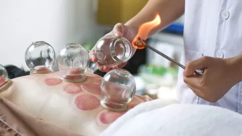 A fire cupping therapy course is essential to build your career as a massage therapist.