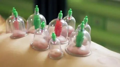 Become a Certified Hijama Specialist