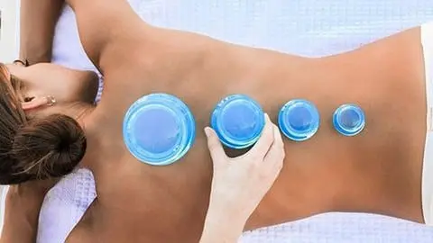 Professional and comprehensive course of cupping techniques and applications